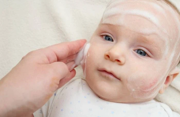 Kako negovati bebinu kožu?